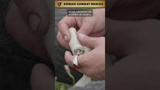 Roman Combat Medics history documentary [upl. by Arivle983]