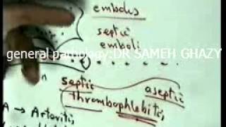 general pathology 7 toxaemia septicaemiapyaemiabacteraemia  repair1 by DR SAMEH GHAZY [upl. by Agata298]