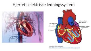 Sirkulasjonssystemet Hjertets elektriske ledningssystem [upl. by Adeline]