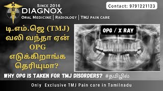 டிஎம்ஜெ TMJ வலி வந்தா ஏன் OPG எடுக்கிறாங்க தெரியுமா TmjPaincare [upl. by Bell81]