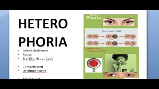 Ophthalmology 357 HeteroPhoria Latent Strabismus Squint Compensation DeCompensation [upl. by Ardnaskela]