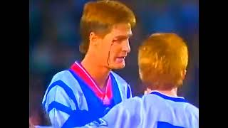 BLOODIED GLASGOW RANGERS HARDSHAW RICHARD GOUGH REFUSES TO LEAVE THE PITCH V LEEDS UNITED 1992 [upl. by Wamsley]