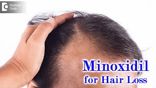 Right way to use MINOXIDIL SOLUTION for HAIR LOSSEXPERT ADVICEDrDeepak P Devakar Doctors Circle [upl. by Rawden]