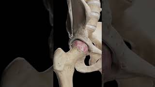 🦴 Hip Arthrosis When the Hip Joint Wears Down anatomy [upl. by Tyoh]