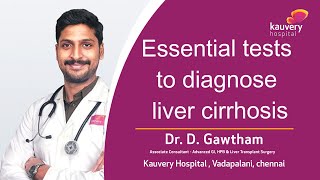 Is Your Liver Healthy Essential Tests for Diagnosing Cirrhosis  Kauvery Hospital Chennai  Tamil [upl. by Swart]