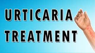 Urticaria Symptoms Treatment and Causes [upl. by Neuberger134]