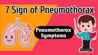 Pneumothorax Symptoms  7 Sign of Pneumothorax [upl. by Eatnhoj]