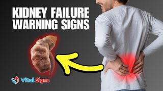 Uncommon Kidney Failure Symptoms You Shouldn’t Ignore  Early Warning Signs amp Prevention Tips [upl. by Bill]