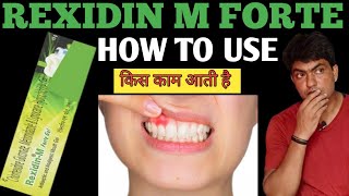 rexidin m forte gel  rexidin m forte gel how to use  rexidin m forte gel uses in hindi [upl. by Gussman887]