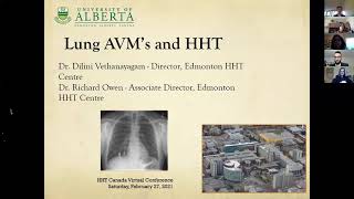 Lung Arteriovenous Malformations AVMs and Hereditary Hemorrhagic Telangiectasia HHT [upl. by Yenahc850]