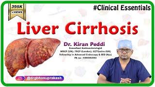 Liver Cirrhosis Clinical essentials  Dr Kiran Peddi MRCPUK FRCPLondon CCTGastro [upl. by Ttevy]