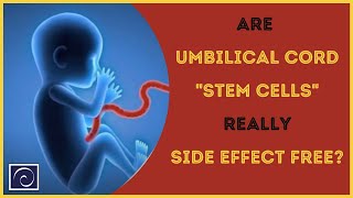 Are Umbilical Cord Stem Cells Really Side Effect Free [upl. by Durrett]