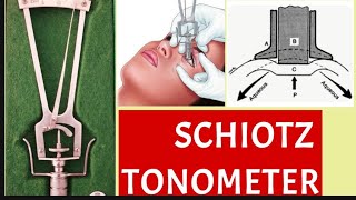 Schiotz Tonometry parts principle procedure and disadvantages [upl. by Mirielle]