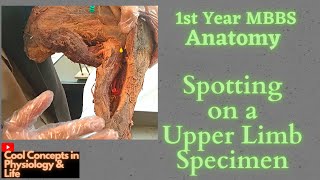 Anatomy Upper limb for spotting in OSPEVIVA VOCE 1st Year MBBS [upl. by Aehtla]