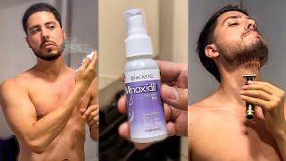 ✅ MINOXIDIL Y BARBA  ▶️ Qué hacer DESPUÉS de aplicar MINOXIDIL  🛑 EVITA COMPLICACIONES 😮 [upl. by Auqinet292]