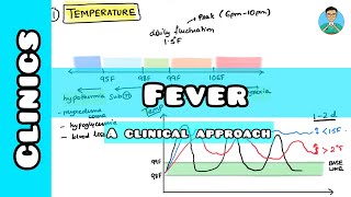 Fever  A step by step clinical approach [upl. by Sidra]