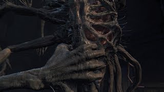 Bloodborne Defiled Chalice Amygdala Solo Strategy [upl. by Ylellan]