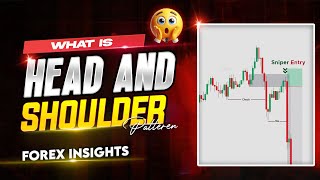 Mastering the Head and Shoulders Pattern A StepbyStep Guide  Forex Insights [upl. by Balbinder]