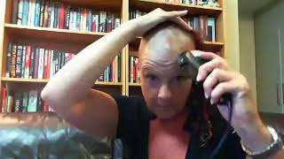 Alopecia Areata Natural Treatment Girl Shaves Her Head Live [upl. by Boccaj842]