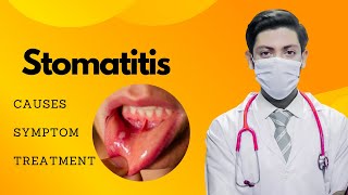 quotStomatitis Symptoms Causes and Treatment  Comprehensive Guide for Oral Healthquot [upl. by Viafore249]