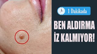 Ben Aldırma Radyofrekans ile 1 Dakikada Hem de İz Kalmadan [upl. by Kevon97]