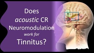 Is CR Neuromodulation Effective for Tinnitus [upl. by Ettenrahs]