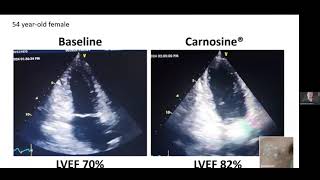 How Carnosine Benefits the Heart [upl. by Veejar889]