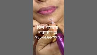 পারমানেন্ট তিল বসানো till তিল tattoos youtubevideo trending [upl. by Adnima]