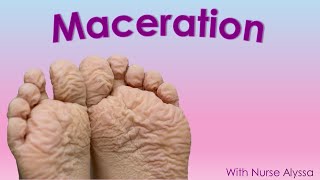 Understanding Wound Maceration [upl. by Einram]