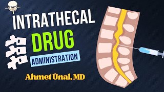 INTRATHECAL DRUG ADMINISTRATION AND CSF SAMPLE  ANIMATION [upl. by Bartle]