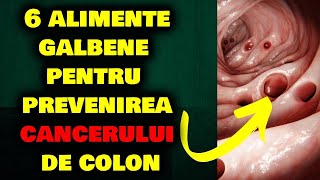 6 ALIMENTE GALBENE PENTRU A PREVENI CANCERUL DE COLON ȘI POLIPII [upl. by Anerec]