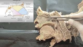 Dissection of nasal septum Anatomy of nasal septum Formation of nasal septum viva exam [upl. by Krusche]