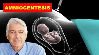 AMNIOCENTESIS MEDICAL DEFINITION OF AMNIOCENTESIS WHAT IS AMNIOCENTESIS [upl. by Oisangi668]