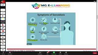 Sarcoidosis  Respiratory Medicine  UrduHindi [upl. by Ardnuaek]