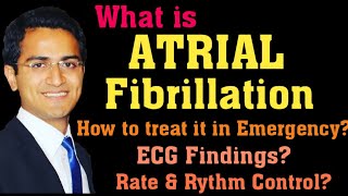 ATRIAL FIBRILLATION AFIB TREATMENT ECG INTERPRETATION PATHOPHYSIOLOGY AFIB MANAGEMENT LECTURE [upl. by Karlis]