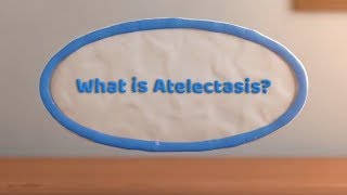 What is Atelectasis Complete or Partial Lung Collapse [upl. by Obmar]