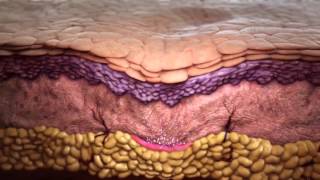 HOW Does Sculptra Work [upl. by Magnusson112]