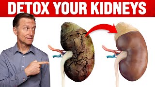 A Surprising Way to Cleanse Toxic Kidneys  Dr Berg on Kidney Detoxification [upl. by Dusza795]