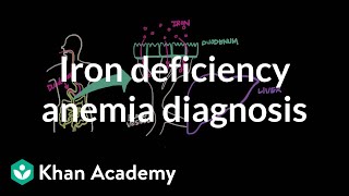 Iron deficency anemia diagnosis  Hematologic System Diseases  NCLEXRN  Khan Academy [upl. by Nrek]