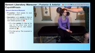 BPPV Treatment  Semont Liberatory Maneuver Why When amp How [upl. by Ier510]