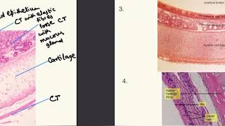 AS Level Biology 9700  Transverse sections of trachea and lungs made extremely easy [upl. by Naryb595]