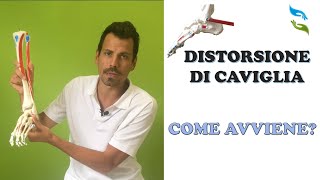 Distorsione di caviglia come avviene cosa aspettarsi [upl. by Swetiana]