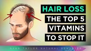 Top 5 Vitamins To PREVENT Hair Loss [upl. by Ieluuk]