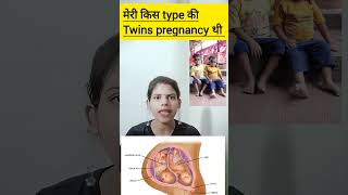 meri kis type ki twins pregnancy thi dichorionic diamniotic twins pregnancy ka kya matlab hota hai [upl. by Soluk]