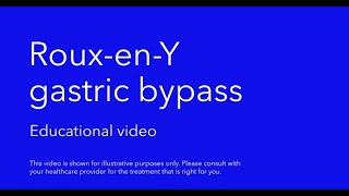 Bariatric roux en y gastric bypass educational video [upl. by Anerahs]