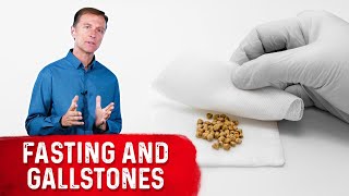 Fasting and Gallstones [upl. by Molloy857]