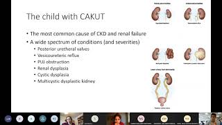 MRCPCH Clinical Exam Teaching  Renal [upl. by Olimpia]