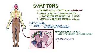 Transverse Myelitis  Osmosis [upl. by Aysan]