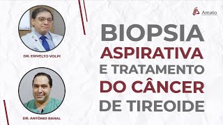 Biopsia Aspirativa por Agulha Fina e Tratamento de Câncer de Tireoide com Ablação [upl. by Eidissac]