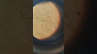 Fungal scraping test  KOH preparation  Fungal hyphae [upl. by Annaili951]